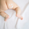 子どもの肌荒れを徹底調査！正しいスキンケアは？皮膚科受診は必要？